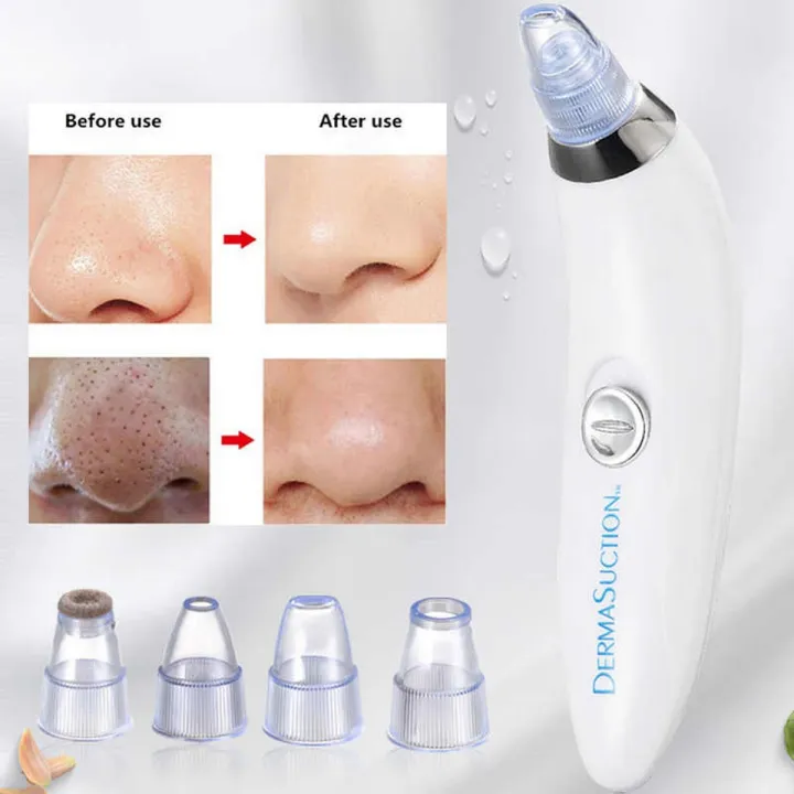 Professional Electric Blackhead Remover & Pore Vacuum Cleaner - Image 3